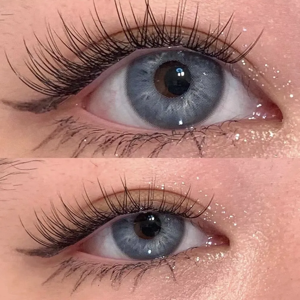 ANESTALENS Irish Blue | 1 Year